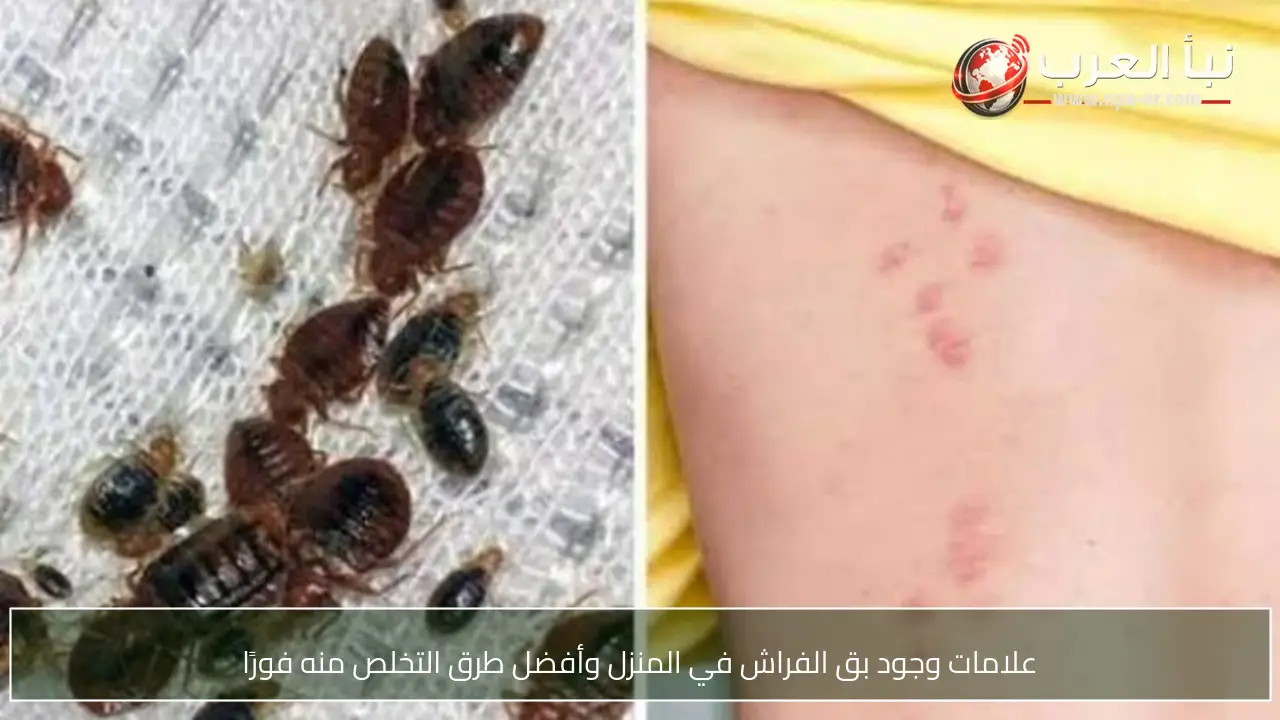 علامات وجود بق الفراش في المنزل وأفضل طرق التخلص منه فورًا